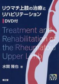 リウマチ上肢の治療とリハビリテーション