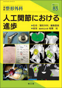 人工関節における進歩 別冊整形外科