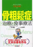 骨粗鬆症の治療と食事療法―組み合わせ自由な新レシピ付き　食事療法・運動療法・日光浴で丈夫な骨を作る