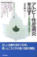 アトピー性皮膚炎を治す - 正しい理解と治療法