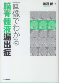 画像でわかる脳脊髄液漏出症