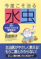 今度こそ治る水虫―足のかゆみ・ただれを“徹底退治”