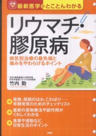 リウマチ・膠原病 - 病気別治療の最先端と痛みをやわらげるポイント　最新