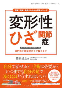 変形性ひざ関節症 図解・即解！基礎からわかる健康シリーズ