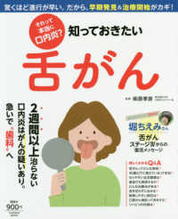 それって本当に口内炎？知っておきたい舌がん - 驚くほど進行が早い。だから、早期発見＆治療開始がカ ＦＵＳＯＳＨＡ　ＭＯＯＫ