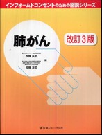 肺がん インフォームドコンセントのための図説シリーズ （改訂３版）