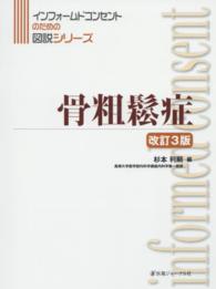 骨粗鬆症 インフォームドコンセントのための図説シリーズ （改訂３版）