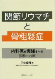関節リウマチと骨粗鬆症 - 内科医が実践すべき診断と治療