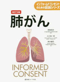 肺がん インフォームドコンセントのための図説シリーズ （改訂第５版）