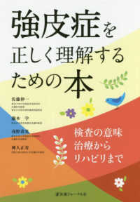 強皮症を正しく理解するための本 - 検査の意味　治療からリハビリまで