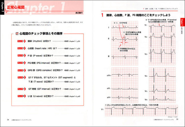 心電図の読み方パーフェクトマニュアル - 理論と波形パターンで徹底トレーニング！_2