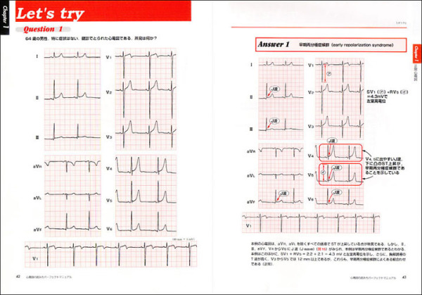 心電図の読み方パーフェクトマニュアル - 理論と波形パターンで徹底トレーニング！_3