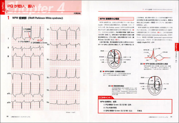 心電図の読み方パーフェクトマニュアル - 理論と波形パターンで徹底トレーニング！_4