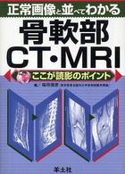 正常画像と並べてわかる骨軟部ＣＴ・ＭＲＩ - ここが読影のポイント