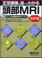 正常画像と並べてわかる頭部ＭＲＩ - ここが読影のポイント （改訂版）