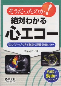 そうだったのか！絶対わかる心エコー - 見てイメージできる判読・計測・評価のコツ