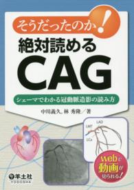 そうだったのか！絶対読めるＣＡＧ - シェーマでわかる冠動脈造影の読み方