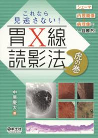 これなら見逃さない！胃Ｘ線読影法虎の巻 - シェーマ＋内視鏡像＋病理像で一目瞭然！