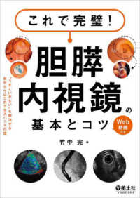 これで完璧！胆膵内視鏡の基本とコツ - “うまくいかない”を解決する目からウロコのエキスパ