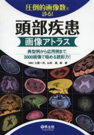 圧倒的画像数で診る！頭部疾患画像アトラス - 典型例から応用例まで、２０００画像で極める読影力！