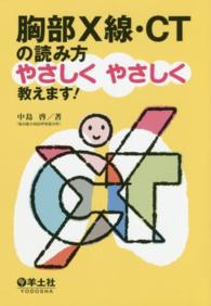 胸部Ｘ線・ＣＴの読み方やさしくやさしく教えます！