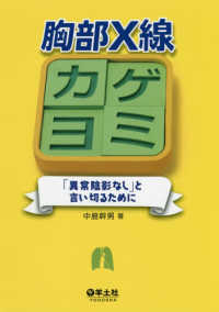 胸部Ｘ線カゲヨミ - 「異常陰影なし」と言い切るために