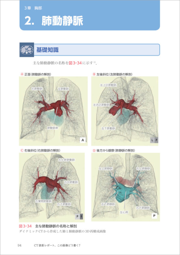 ＣＴ読影レポート、この画像どう書く？ - 解剖・所見の基礎知識と、よくみる疾患のレポート記載_2