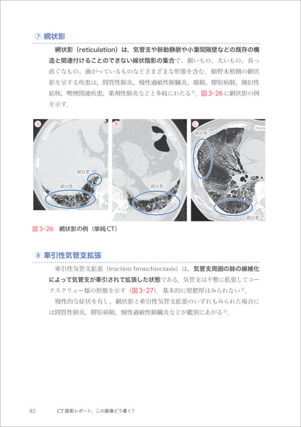 ＣＴ読影レポート、この画像どう書く？ - 解剖・所見の基礎知識と、よくみる疾患のレポート記載_5