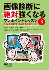 画像診断に絶対強くなるワンポイントレッスン 〈３〉 何ひとつ見逃さないための読影のポイント！