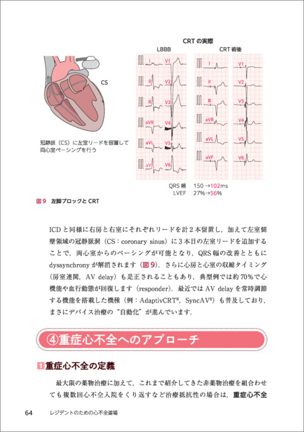 レジデントのための心不全道場_4