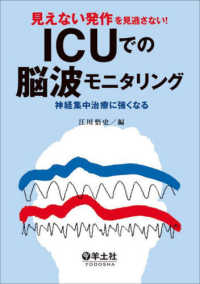 見えない発作を見逃さない！ＩＣＵでの脳波モニタリング