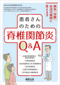 患者さんのための脊椎関節炎Ｑ＆Ａ - 病気・治療・生活の疑問に答えます