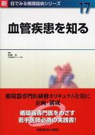 血管疾患を知る 新目でみる循環器病シリーズ