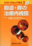 胆道・膵の治療内視鏡 ＤＶＤ－Ｖｉｄｅｏで見る