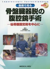 動画で見る骨盤臓器脱の腹腔鏡手術 - 仙骨腟固定術を中心に