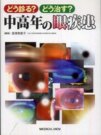 どう診る？どう治す？中高年の眼疾患