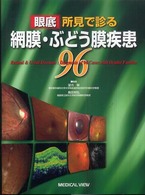 眼底所見で診る網膜・ぶどう膜疾患９６