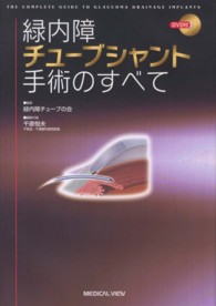 緑内障チューブシャント手術のすべて