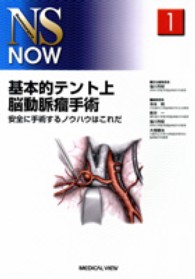 基本的テント上脳動脈瘤手術 - 安全に手術するノウハウはこれだ ＮＳ　ｎｏｗ