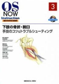 下肢の骨折・脱臼手技のコツ＆トラブルシューティング ＯＳ　ｎｏｗ　ｉｎｓｔｒｕｃｔｉｏｎ整形外科手術の新標準