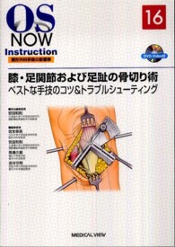 膝・足関節および足趾の骨切り術 - ベストな手技のコツ＆トラブルシューティング ＯＳ　ｎｏｗ　ｉｎｓｔｒｕｃｔｉｏｎ整形外科手術の新標準