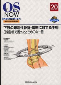 下肢の難治性骨折・病態に対する手術 - 日常診療で困ったときのこの一冊 ＯＳ　ｎｏｗ　ｉｎｓｔｒｕｃｔｉｏｎ整形外科手術の新標準
