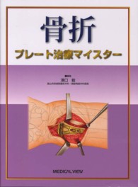 骨折プレート治療マイスター