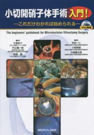 小切開硝子体手術入門！ - これだけわかれば始められる