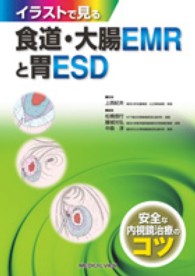 イラストで見る食道・大腸ＥＭＲと胃ＥＳＤ - 安全な内視鏡治療のコツ