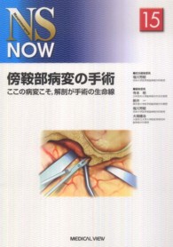 傍鞍部病変の手術 - ここの病変こそ，解剖が手術の生命線 ＮＳ　ｎｏｗ