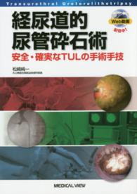 経尿道的尿管砕石術―安全・確実なＴＵＬの手術手技