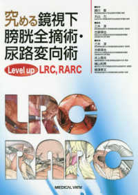 究める鏡視下膀胱全摘術・尿路変向術 - Ｌｅｖｅｌ　ｕｐ　ＬＲＣ，ＲＡＲＣ