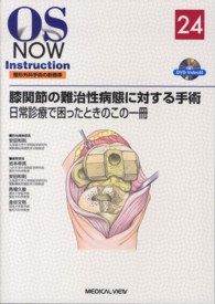 膝関節の難治性病態に対する手術 - 日常診療で困ったときのこの一冊 ＯＳ　ｎｏｗ　ｉｎｓｔｒｕｃｔｉｏｎ整形外科手術の新標準
