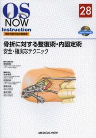 骨折に対する整復術・内固定術 - 安全・確実なテクニック ＯＳ　ｎｏｗ　ｉｎｓｔｒｕｃｔｉｏｎ整形外科手術の新標準
